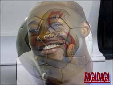 fadiga